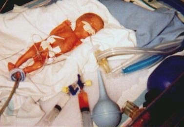 Harris born March 28, 2000